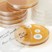 Mould In a Petrie dish Mould In a Petrie dish