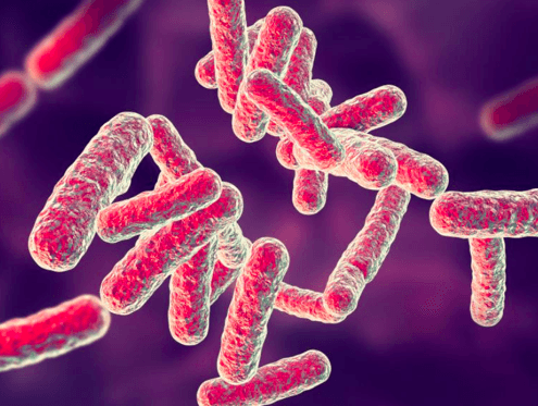 Pseudomonas aeruginosa